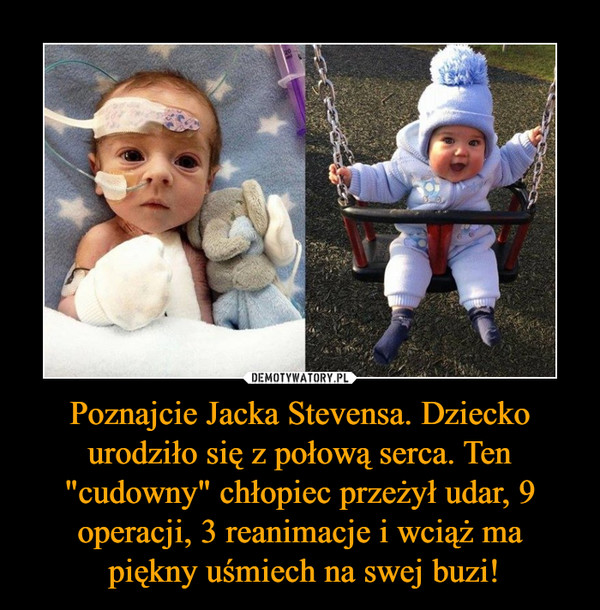 Poznajcie Jacka Stevensa. Dziecko urodziło się z połową serca. Ten "cudowny" chłopiec przeżył udar, 9 operacji, 3 reanimacje i wciąż ma
 piękny uśmiech na swej buzi!