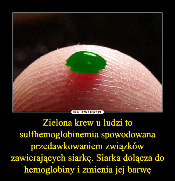 Zielona krew u ludzi to sulfhemoglobinemia spowodowana przedawkowaniem związków zawierających siarkę. Siarka dołącza do hemoglobiny i zmienia jej barwę –  