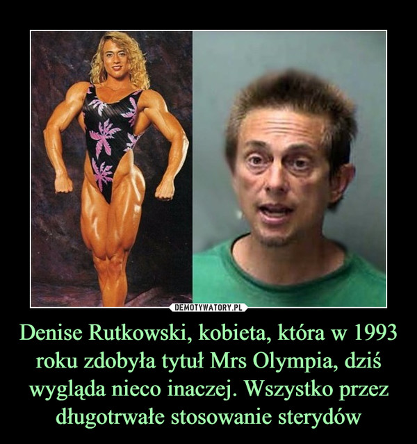 Denise Rutkowski, kobieta, która w 1993 roku zdobyła tytuł Mrs Olympia, dziś wygląda nieco inaczej. Wszystko przez długotrwałe stosowanie sterydów –  