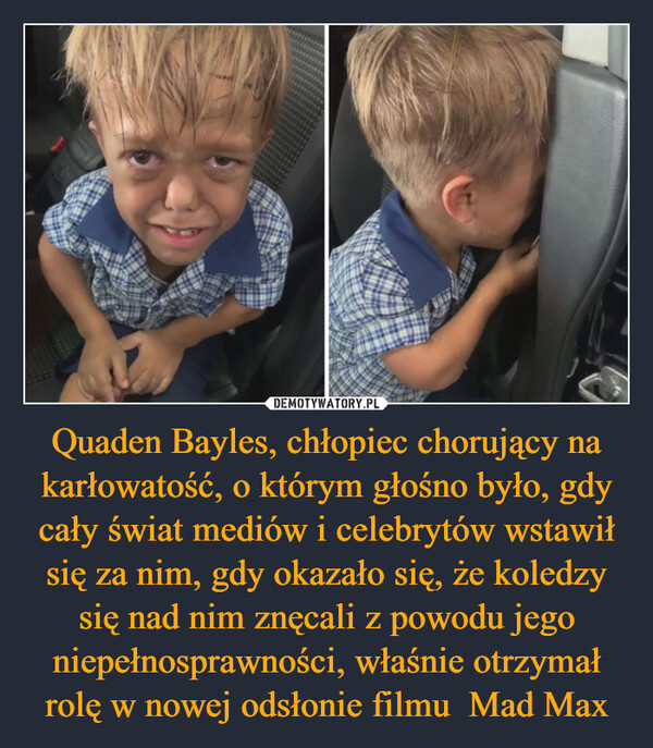 Quaden Bayles, chłopiec chorujący na karłowatość, o którym głośno było, gdy cały świat mediów i celebrytów wstawił się za nim, gdy okazało się, że koledzy się nad nim znęcali z powodu jego niepełnosprawności, właśnie otrzymał rolę w nowej odsłonie filmu  Mad Max