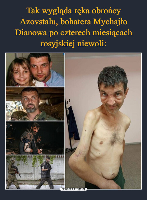 Tak wygląda ręka obrońcy Azovstalu, bohatera Mychajło Dianowa po czterech miesiącach rosyjskiej niewoli: